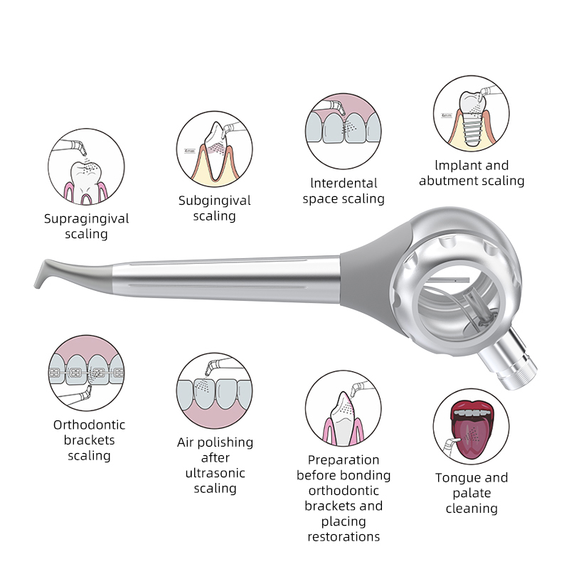 VVDental NEW 올메탈 샌드블라스트 스케일러 샌 - Sandblaster Cabinet 리뷰 및 가격